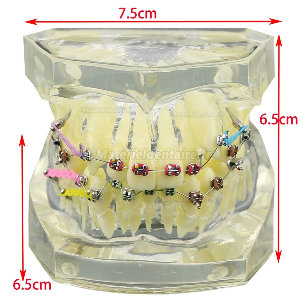 Modèle de dents dentaires étude de dentition modèle orthodontique matériaux  dentaires - Chine Modèle d'enseignement dentaire, produits dentaires